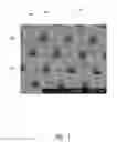 Fig. 02 - Silicon substrate optimization for microarray technology