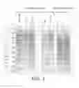 Fig. 02 - PROTEIN-BASED METHODS AND COMPOSITIONS FOR THE DIAGNOSIS OF COLORECTAL ADENOCARCINOMA