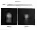 Fig. 02 - Method for treating hair growth disorders, such as female pattern alopecia, and compositions useful therefore
