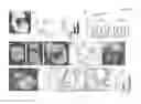 Fig. 02 - Methods of modulating smooth muscle cell proliferation and differentiation