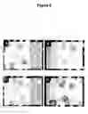 Fig. 07 - Methods for treating rheumatoid arthritis with anti-bile salt-stimulated lipase (BSSL) antibodies