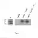 Fig. 06 - Modified protozoan expressing at least two variable surface proteins (VSP), a vaccine comprising it and procedures, uses, and methods thereof