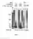 Fig. 09 - Modified protozoan expressing at least two variable surface proteins (VSP), a vaccine comprising it and procedures, uses, and methods thereof