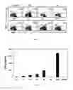 Fig. 02 - AMINOCYCLITOL COMPOUNDS, PROCESS FOR OBTAINING THEM AND USES