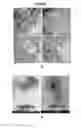 Fig. 02 - THERAPEUTIC VESICLES