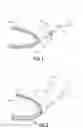 Fig. 02 - Method for repairing an airfoil surface having an elastomeric protective coating
