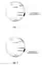 Fig. 02 - Nucleic acids encoding for antifungal bifunctional molecules for treating fungal infection