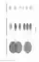 Fig. 14 - Compositions and methods for prediction of drug sensitivity, resistance, and disease progression