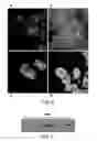 Fig. 06 - Polysialic acid derivatives, methods of production, and uses in enhancing cancer antigen production and targeting