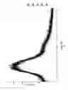 Fig. 02 - Intermediate of Ertapenem, a composition comprising the same and preparation methods thereof
