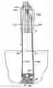 Fig. 01 - Systems, devices, and methods for minimally invasive pelvic surgery
