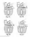 Fig. 28 - Systems, devices, and methods for minimally invasive pelvic surgery