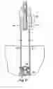 Fig. 41 - Systems, devices, and methods for minimally invasive pelvic surgery