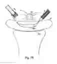 Fig. 63 - Systems, devices, and methods for minimally invasive pelvic surgery