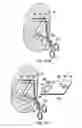 Fig. 80 - Systems, devices, and methods for minimally invasive pelvic surgery
