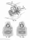 Fig. 83 - Systems, devices, and methods for minimally invasive pelvic surgery