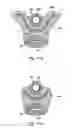 Fig. 89 - Systems, devices, and methods for minimally invasive pelvic surgery