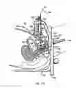 Fig. 97 - Systems, devices, and methods for minimally invasive pelvic surgery