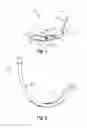 Fig. 02 - INSERTION SECTION FOR LARYNGOSCOPE WITH LATERAL TUBE GUIDE