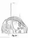 Fig. 06 - Expandable spinal access instruments and methods of use