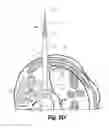Fig. 09 - Expandable spinal access instruments and methods of use