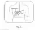 Fig. 04 - MRI T1 image-guided tissue diagnostics