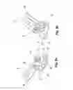 Fig. 07 - Disposable biopsy unit