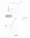Fig. 04 - Systems and methods for parenterally procuring bodily-fluid samples with  reduced contamination