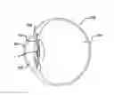 Fig. 01 - Intra ocular lens