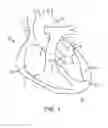 Fig. 02 - System for providing surgical access