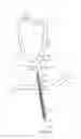 Fig. 04 - System for providing surgical access