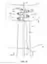 Fig. 20 - System for providing surgical access