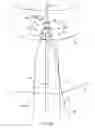 Fig. 23 - System for providing surgical access