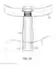 Fig. 34 - System for providing surgical access