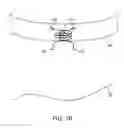 Fig. 35 - System for providing surgical access