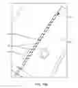 Fig. 41 - System for providing surgical access