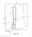 Fig. 45 - System for providing surgical access