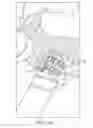 Fig. 47 - System for providing surgical access