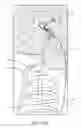 Fig. 49 - System for providing surgical access