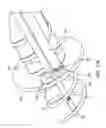 Fig. 72 - System for providing surgical access