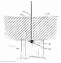 Fig. 01 - Surgical delivery instrument and method