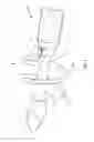 Fig. 08 - Surgical delivery instrument and method