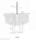 Fig. 09 - Surgical delivery instrument and method