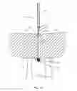 Fig. 12 - Surgical delivery instrument and method