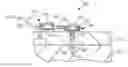 Fig. 01 - INJECTION PORT SYSTEM FOR INTRA-MARROW INJECTION/INFUSION