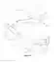 Fig. 07 - Stem cell delivery device for orthobiologics applications