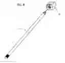 Fig. 06 - Spinal surgery distraction with an integrated retractor