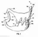 Fig. 02 - Apparatus and Method for Compressing Body Tissue