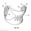 Fig. 28 - Apparatus and Method for Compressing Body Tissue