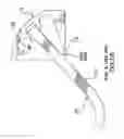 Fig. 65 - Apparatus and Method for Compressing Body Tissue